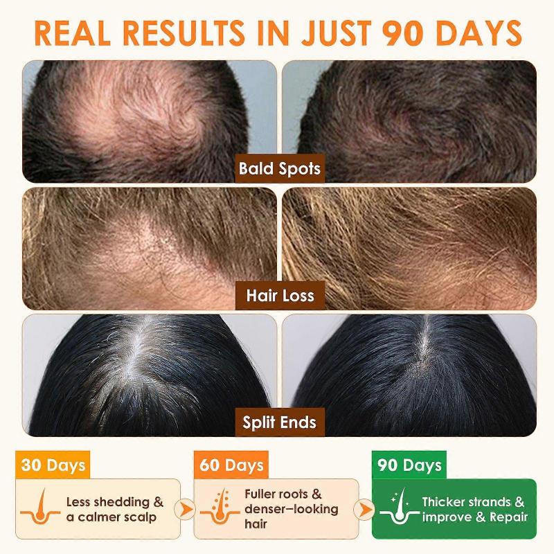 2 In 1 Raw Batana Oil for Hair Growth Set - 100% Pure Organic Batana Oil for Thicker & Stronger Hair - Batana Oil with Rosemary & Jojoba Oil, Prevent 