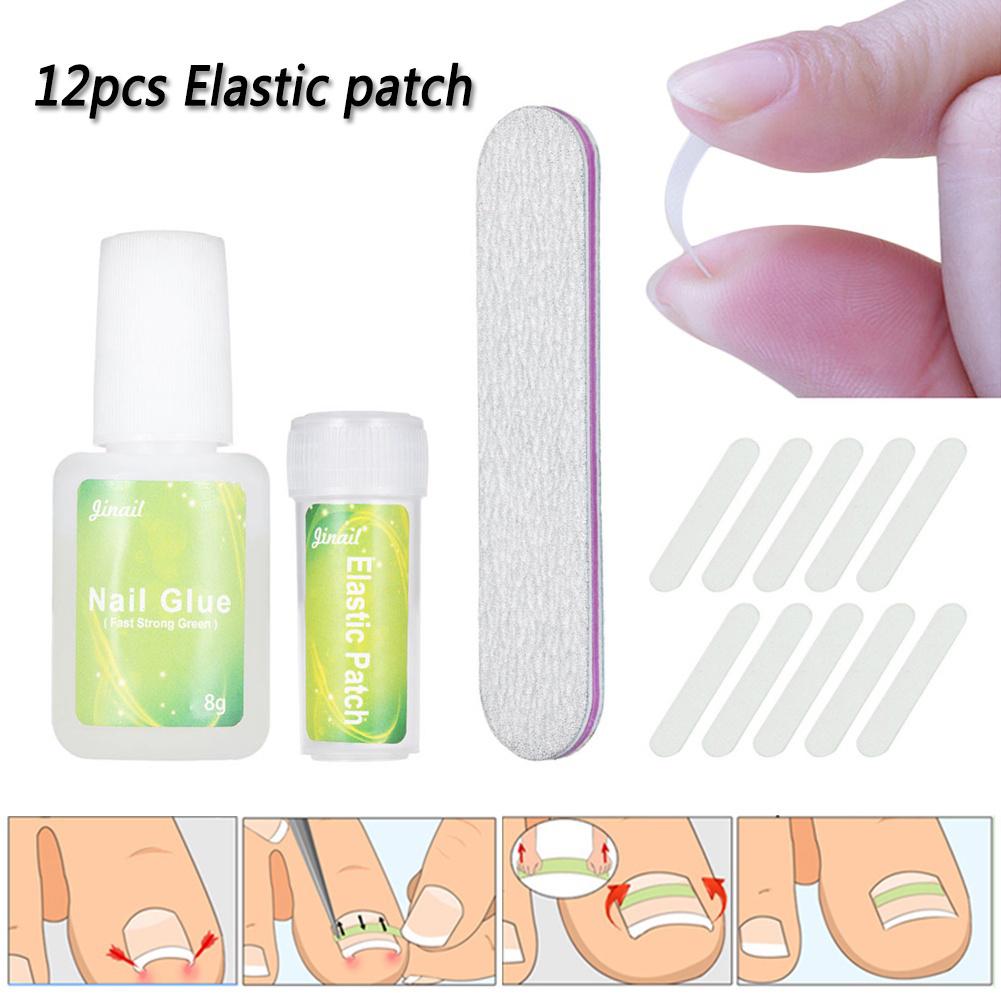 Clinging 12Pcs Ingrown Toenail Correction Pedicure Tool Elastic Patch Straightening Clip
