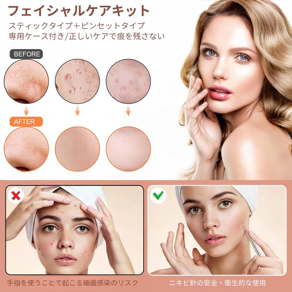 Blackhead Remover Acne Hair and Acne Antibacterial Stainless Steel Pore Care Kit with Tip Stainless Steel Acne Blackhead Strawberry Nose Pore Portable