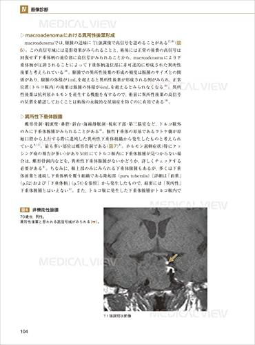 Pituitary gland imaging