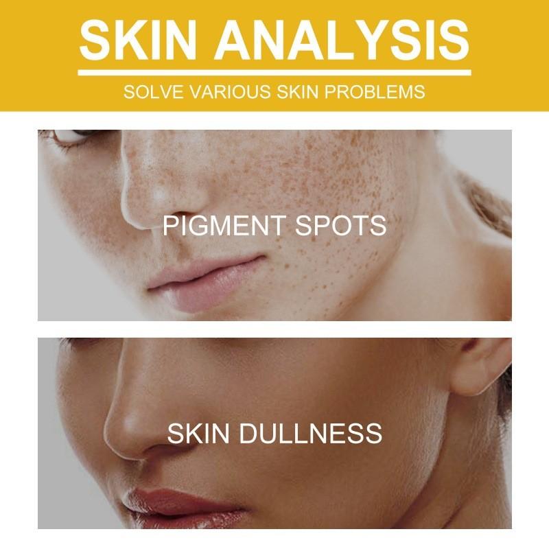 Wiyun Brightening V7 Cream For Enhanced Skin Texture And Hydration With Formula Antiwrinkle