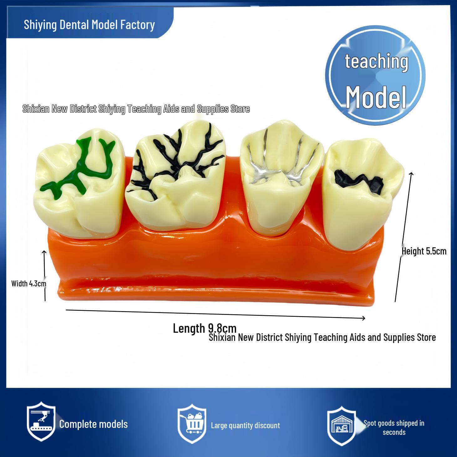 Children s Dental Model: Sealant & Restoration Simulation with Disassemblable Tooth Resin