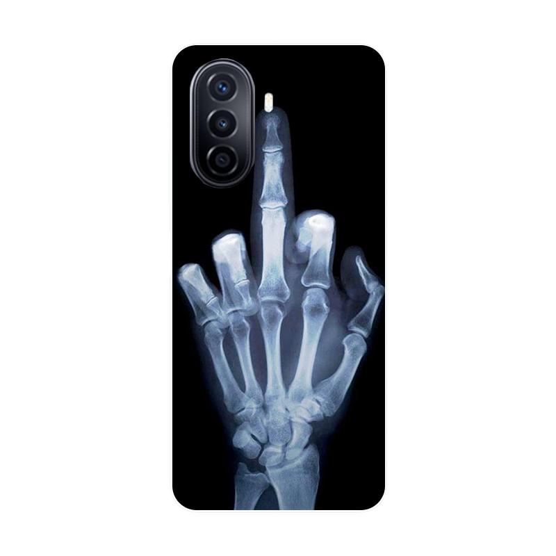 Phone Case For Huawei Nova Y70 Plus Case Bumper Soft Silicon Cover For Huawei Nova Y70 Plus Cool Cartoon Case Nova Y70Plus Coque