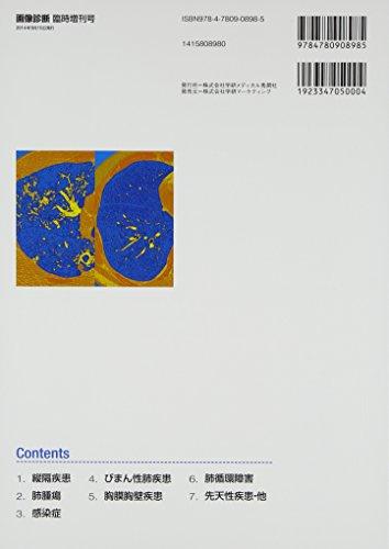 50 Chest Imaging Diagnoses Learned through Case Comparison