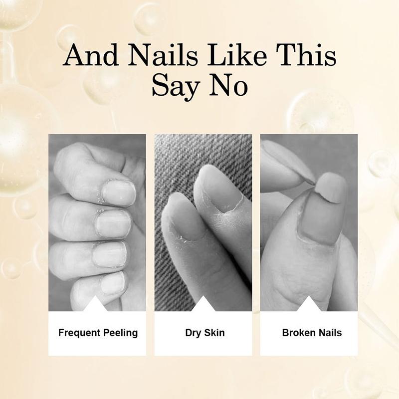8Ml Nail Nutrition Oil Pen 6 Smells Nail Treatment Cuticle Repair Oil Prevent Agnail Nail Polish Nourish Skin Remedy Manicure