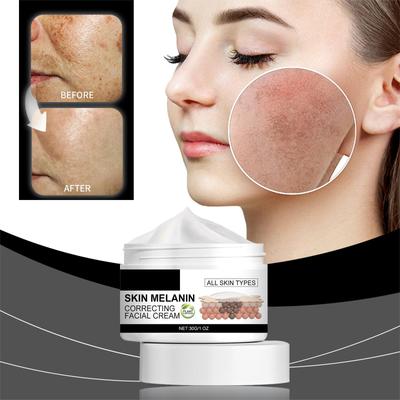 Pleťový krém korigující melanin, Pleťový krém;Rozjasňující pleťový krém, Pleťový krém pro obnovu mdlé pleti, 30g