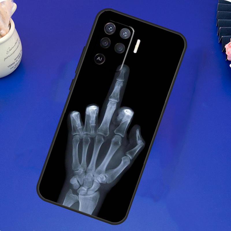 Skeleton Middle Finger Case For OPPO A17 A57 A77 A78 A15 A16 A52 A72 A76 A96 A74 A94 A5 A9 A31 A93 A54S A53S A57S