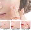 Acne Patch Facial Repair Acne Clean Pores Moisturize And Smooth Skin Acne Patch Facial Stickers Skin Care Tools