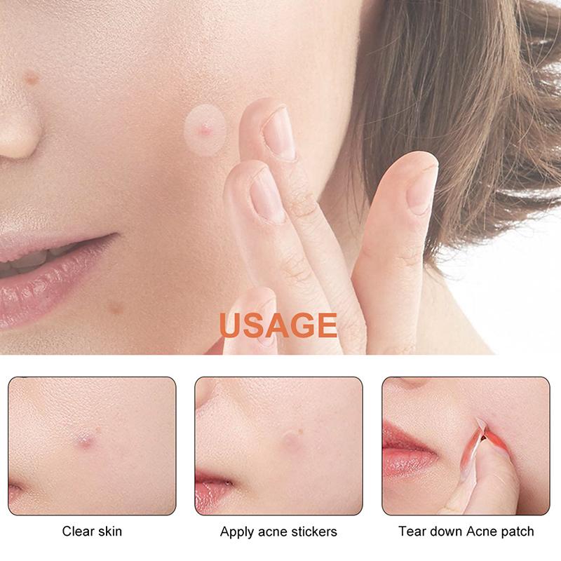 Acne Patch Facial Repair Acne Clean Pores Moisturize And Smooth Skin Acne Patch Facial Stickers Skin Care Tools