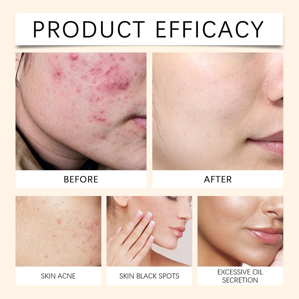 Hydrating Relieves Redness And Nourishes Skin Daily Hydrating Spray 100ml