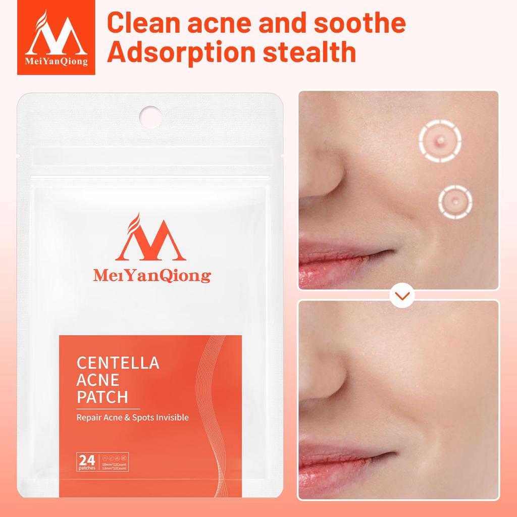 MeiYanQiong Centella Acne Patch Stickers Acne Treatment Pimple Remover Tool Blemish Spot Facial Mask Skin Care Waterproof 24 Patches