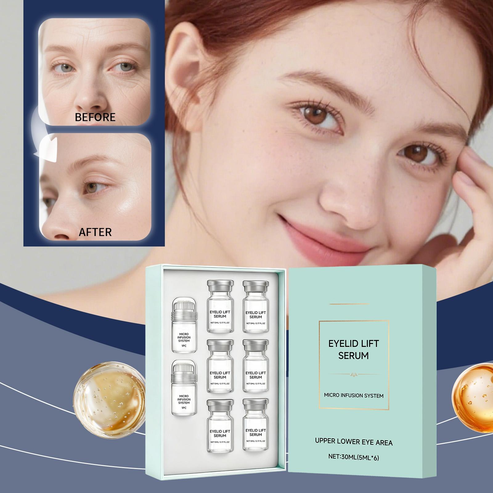 

Eye Care Liquid Microneedle Set Reduces Fine Lines Eye Corner Wrinkles Daily Care And Moisturizing 30ML One Size белый