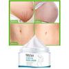 Smoothing Skin Stretch Mark Cream, Gentle and Non-irritating, Smooths Wrinkles and Fades Fine Lines