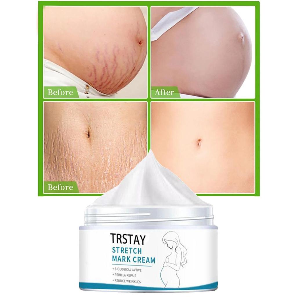 Smoothing Skin Stretch Mark Cream, Gentle and Non-irritating, Smooths Wrinkles and Fades Fine Lines
