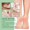 Ouhoe Cracked Heel Repair Cream Nourishing And Moisturizing Foot Balm For Soft Feet