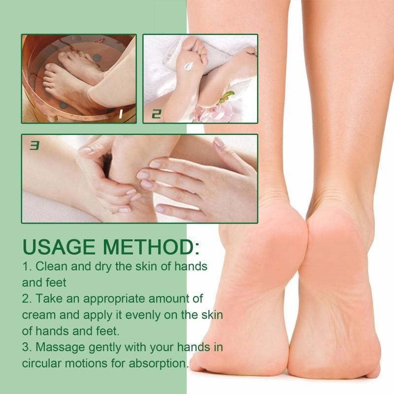 Ouhoe Cracked Heel Repair Cream Nourishing And Moisturizing Foot Balm For Soft Feet
