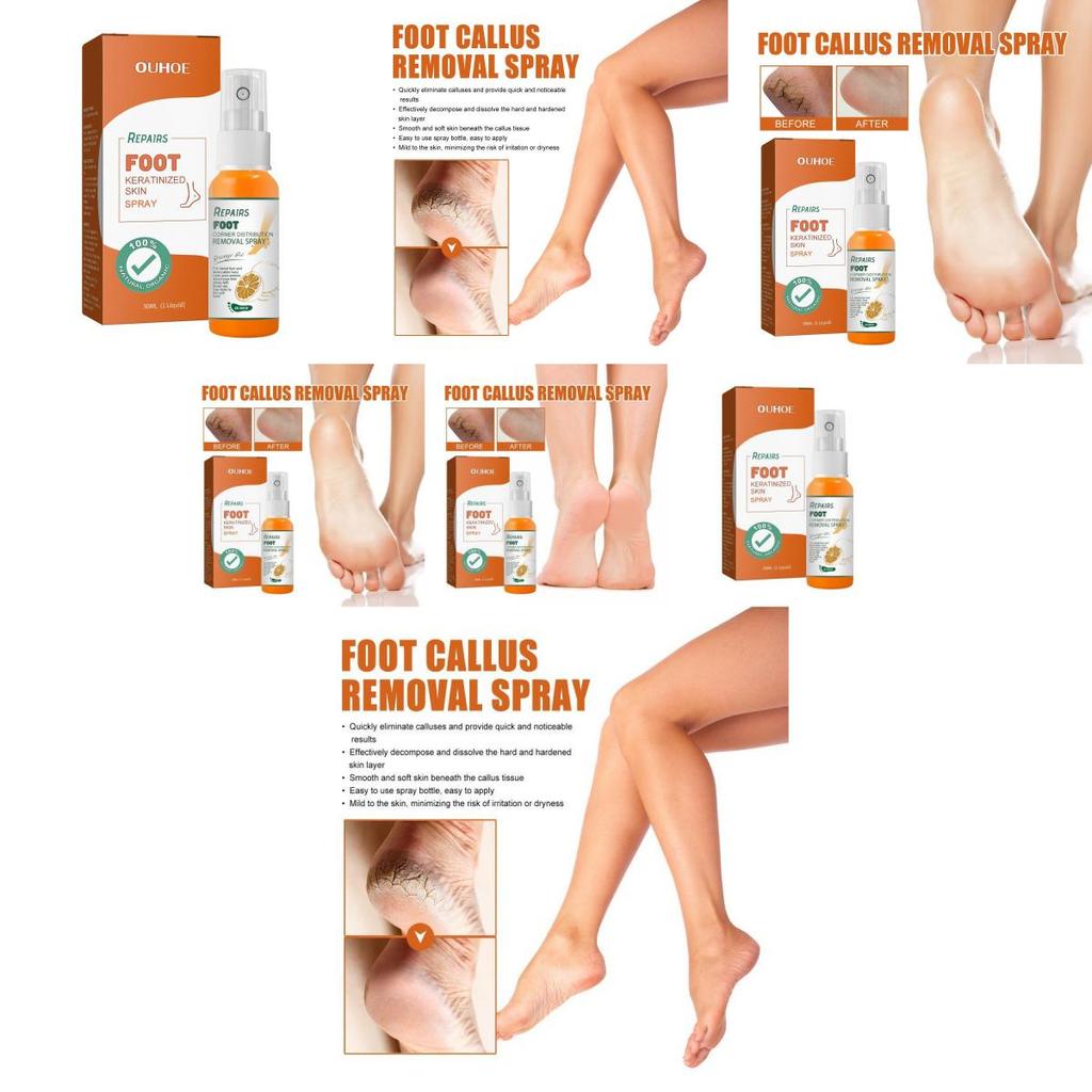 Nourishing Ouhoe Foot Spray For Softening Calluses And Cracked Heels 30ml