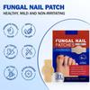 Zachte schimmelnagelpleisters Makkelijk te gebruiken Draagbare teennagelpleisters Effectieve nagelweerstand Nagels Herstelpleisters voor Beschadigde Nagels