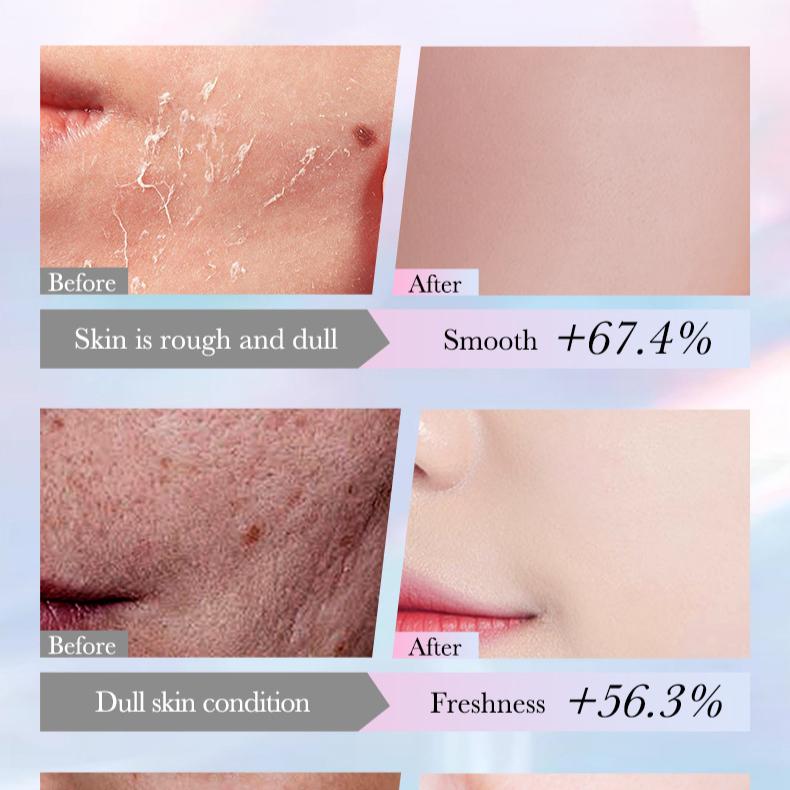 Maschera schiarente e anti-lentiggini alla niacinamide 30 g Maschera riparatrice e idratante