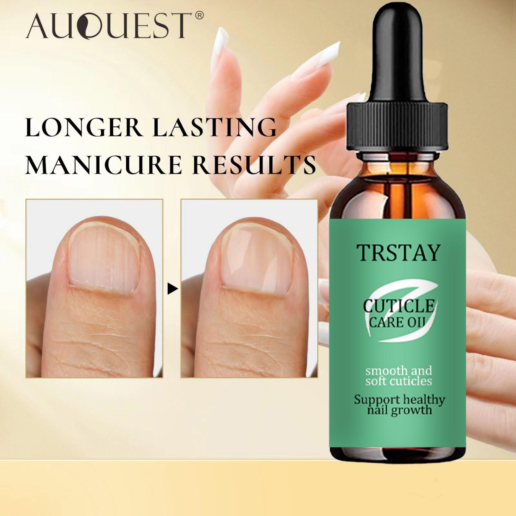 

Эссенция для ухода за ногтями с натуральными ингредиентами для улучшения внешнего вида ногтей и поддержания их в хорошем состоянии