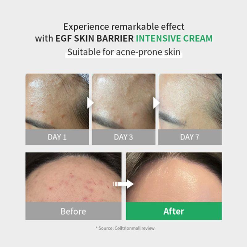 [zipiderm] EGF Skin Barrier Intensive Cream 80ml