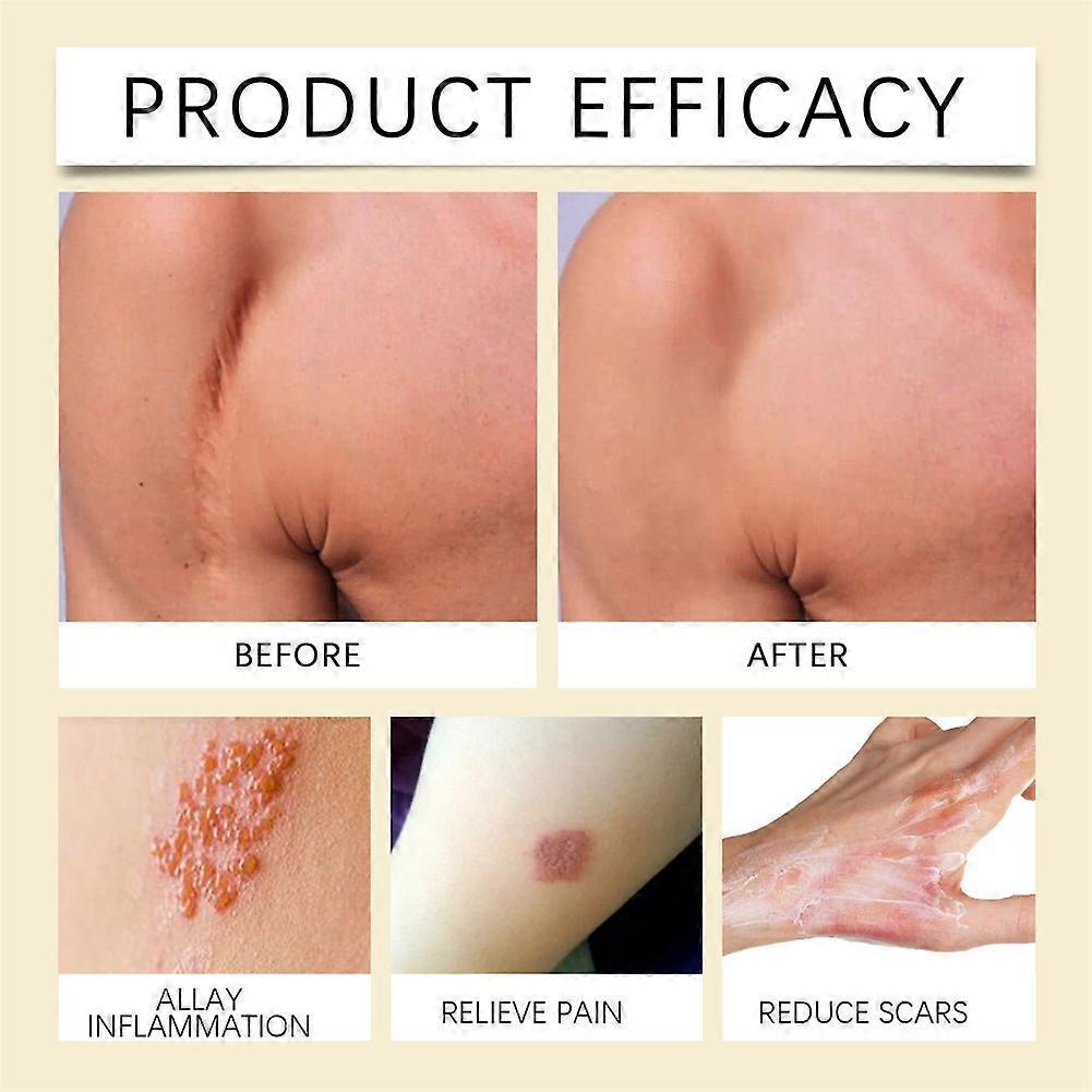 Antibacterial Honey Healing Patches for Cuts, Burns & Scrapes, Natural Wound Recovery with Tea Tree Oil, Soft Skin-Friendly Adhesive