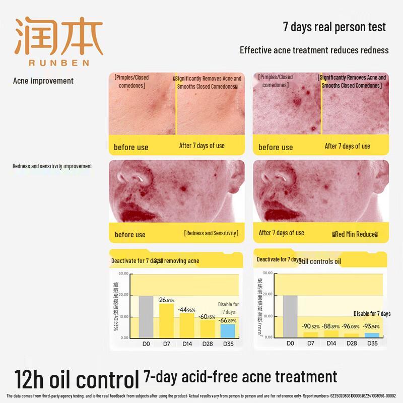 RUNBEN Teenager 12h Oil Control Acne Treatment Moisturizing Essence Lotion