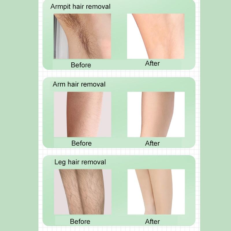 9999999 Flash IPL Laser Depilator Professional Permanent LCD Laser Hair Removal Women Painless Hair Remover Machine 12V