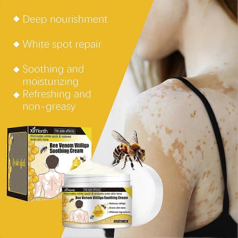 Bee Venom Vitiligo Cream, Natural Anti-Vitiligo Cream for Reduce White Spots & Improve Skin Pigmentation
