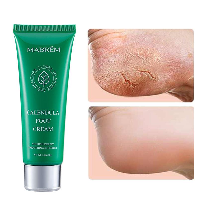 

Крем для ухода за ногами, отбеливающий, против растрескивания, увлажняющий, уход за ногами, отшелушивающий скраб, против сухости, календула, оливковое восстановление