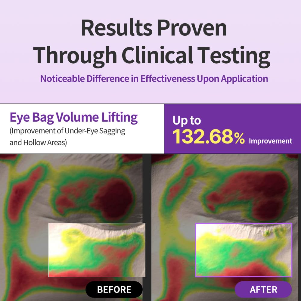 COSCELL Retinol Lifting Eye Back Cream Eye Firming Korean Cosmetics 60-Second Volume! 10ml, Area, Skin,