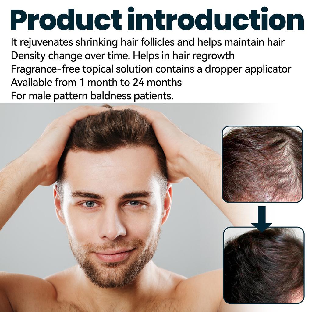 East Moon Men's Hair Treatment – Moisturizing & Nourishing Formula for Stronger, Smoother & Well-Groomed Hair