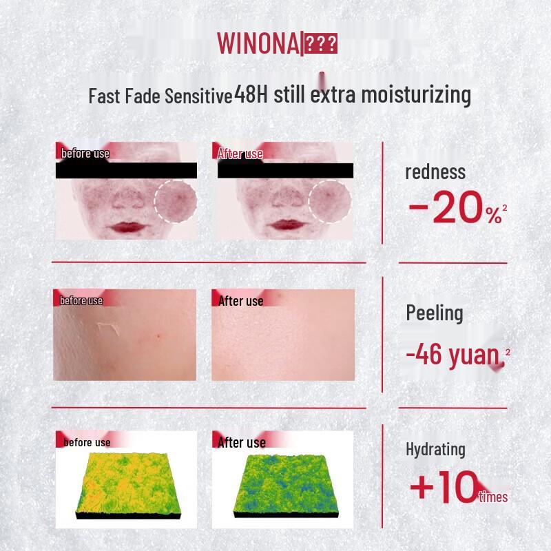 Winona 2nd Generation Sensitive Skin Relief Cream