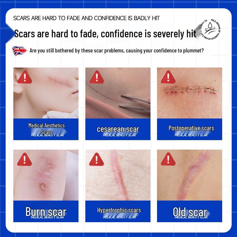 Advanced Scar Repair Treatment Gel