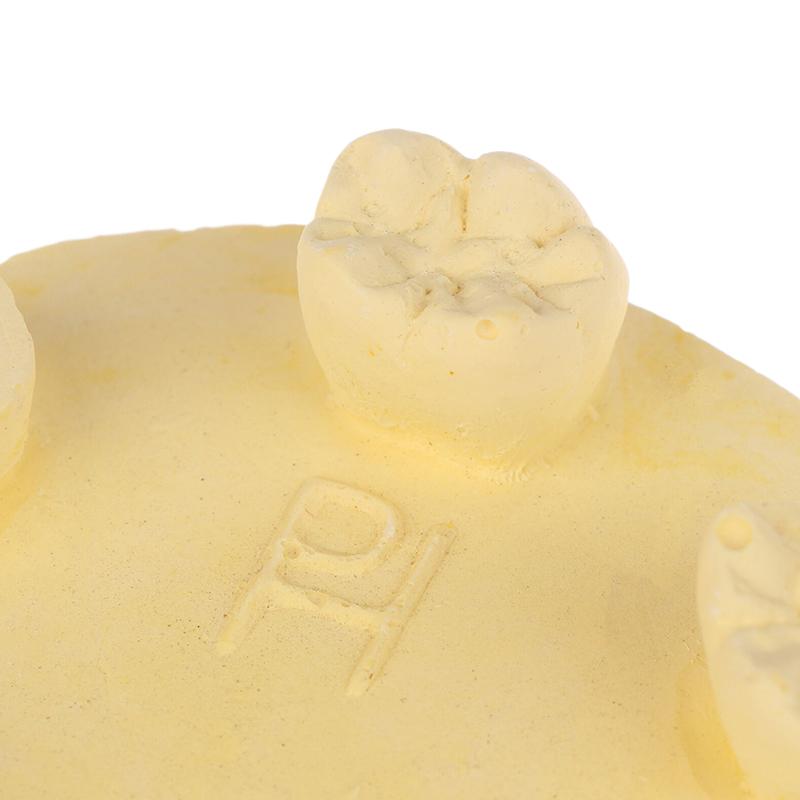 Dental Inlay Exercise Model Block Filling Exercise Plaster/Resin Materials Oral Filling Model For Dentistry Teaching Study