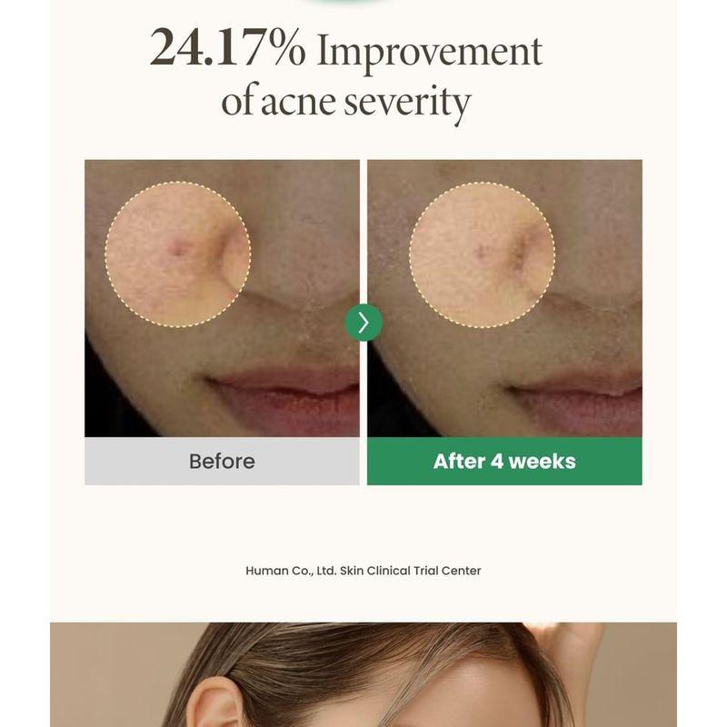 AXIS - Y - Spot The Difference Blemish Treatment
