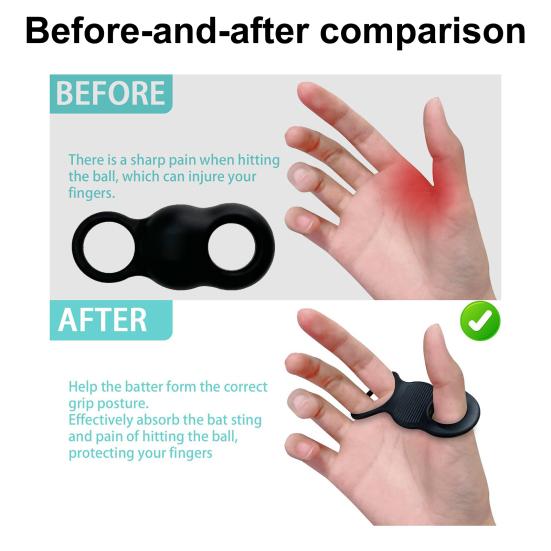 Baseball-Daumenschutz, Silikon-Baseball-Schlaggriff-Zubehör, Softball-Schwung-Trainingshilfe zur Reduzierung des Schlägerstichs