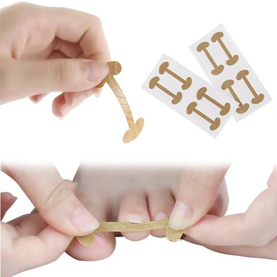 10Pcs Ingrown Toenail Correction Patches Nail Straightener for Pain Relief & Nail Recovery Ingrown Toenail Corrector Kit for Toenail Fungus