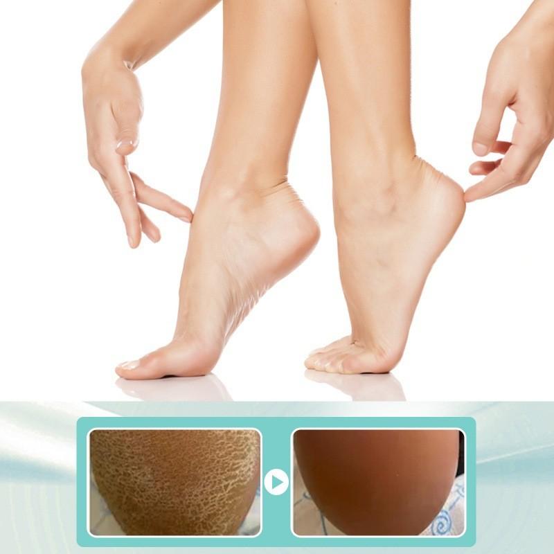 Ouhoe Moisturizing Foot Cream For Dry Cracked Heels And Rough Skin Repair 100g