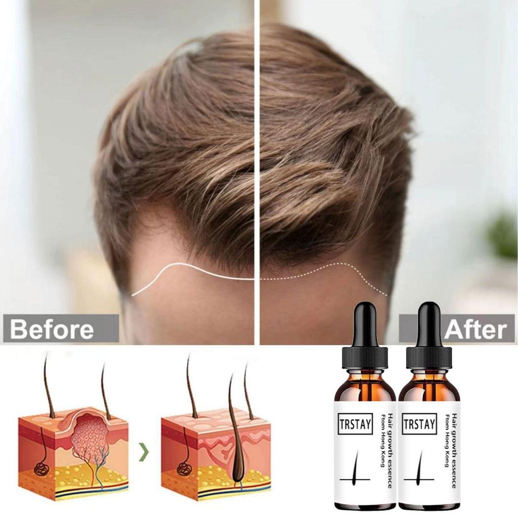 Hair Care Solution, Thick Moisturizing and Softening Agent, Long Hair Essential Oil