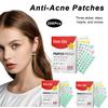 200Pcs Acne Patches Fade Blemishes Pimple Marks Closed Acne Blemishes Hydrocolloid Star Heart Shaped Cover Acne Pimple Patch