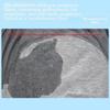 Antibacterial Graphene Adult Diaper Pants Leak-Proof Incontinence Underwear  Elderly Care