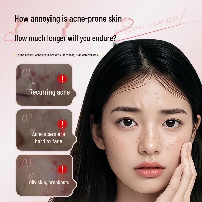 Bailingniao Salicylic Acid Acne & Mark Repair Cream