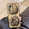 Human Heart Anatomy For Xiaomi POCO C65 F5 X5 X4 X3 Pro F3 F4 M5s Mi 14 13 Pro 11T 12T 13T 12 Lite Phone Case