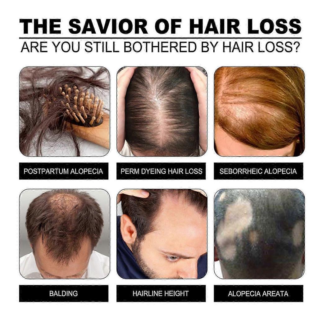 Nourishing Hair Care Soap for Hair Growth & Scalp Relief - Gentle, Natural Cleanser with Glycerin & Sodium Palmitate, Promotes Thicker, Resilient Hair