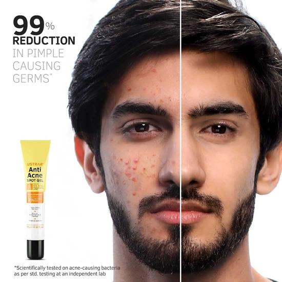 Ustraa Anti-Acne Spot Gel - 15 ml (Set of 2) | Reduces 99.9% Pimple-causing Germs | 2% Salicylic Acid - Removes Dead Skin & Clears Pores