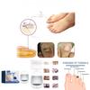 Comprehensive Nail Care Treatment South Moon Targets Yellow Nails Ingrown Nails