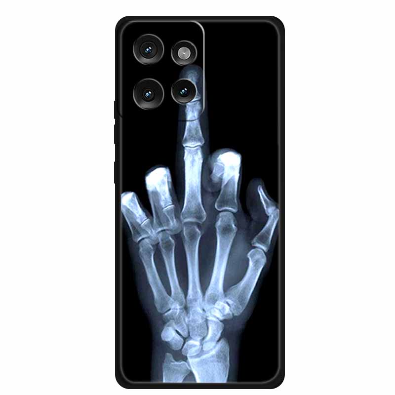 For Motorola Moto G75 5G Case Animals Soft Silicone TPU Phone Cases Back Cover for MotoG75 Shockproof Protective New Cool Fundas