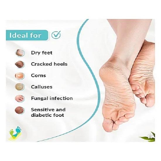 Fixderma Foobetik Cream Fußcreme für rissige Füße spendet Feuchtigkeit und repariert 50 g