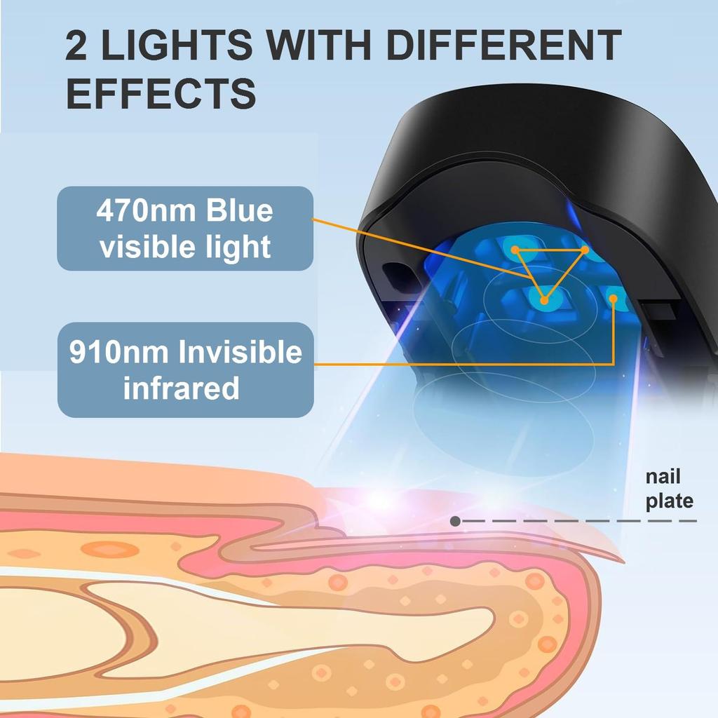 Nail Fungus Cleaning Laser Light, Used For Onychomycosis, USB Charging 905nm Infrared Light 470nm Blue Light